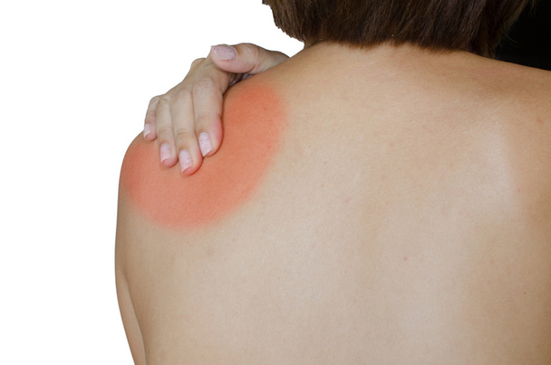 Acute pain in a woman shoulder. - Photo, image