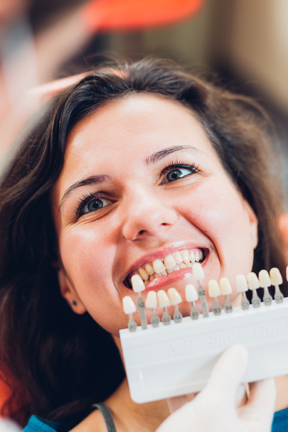 Testare il candore del dente del paziente
 - Foto, immagini