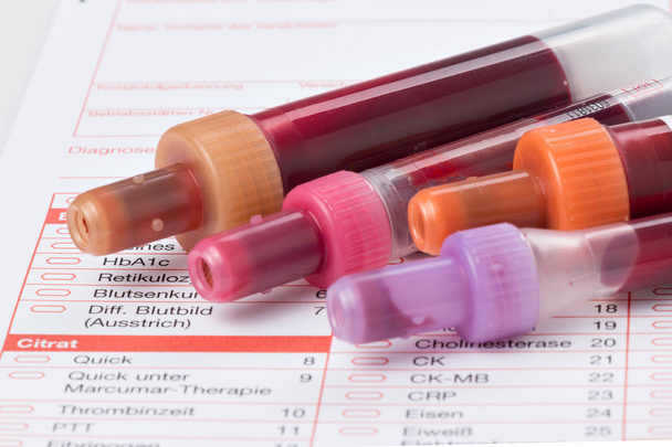 Εξέταση αίματος, δείγματα αίματος σε μια φόρμα εργαστηρίου - Φωτογραφία, εικόνα