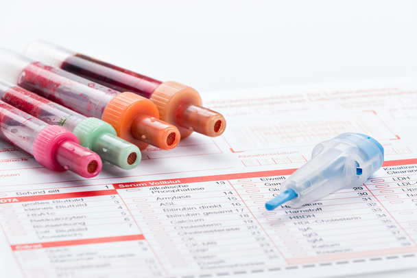 Blood test, blood samples on a laboratory form - Photo, Image