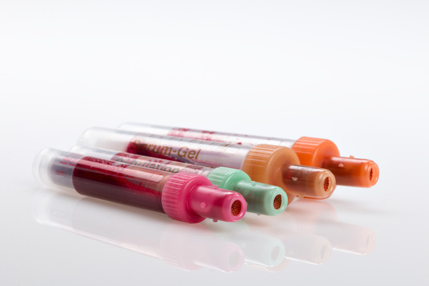 Krevní test, vzorky krve na laboratorní formuláře - Fotografie, Obrázek