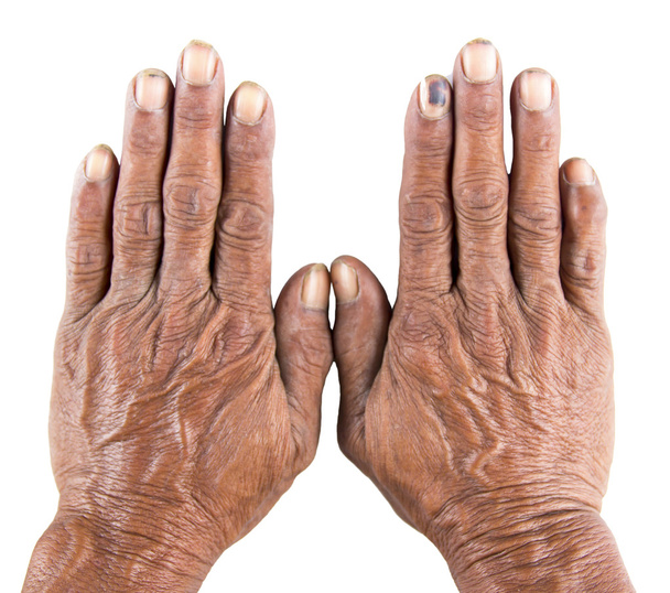 Öregember kéz  - Fotó, kép