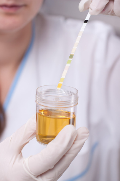 Donna che fa il test delle urine
 - Foto, immagini
