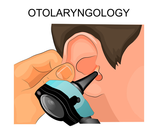 examen de l'oreille à l'aide de l'otoscope. otolaryngologie
 - Vecteur, image