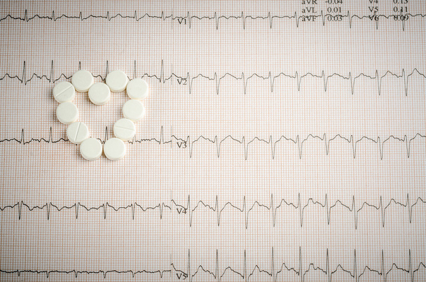 orvosi vizsgálat, EKG, szív gyógyszert és thera - Fotó, kép