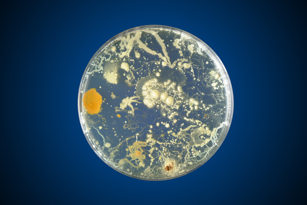 Bakterien wachsen in einer Petrischale - Foto, Bild