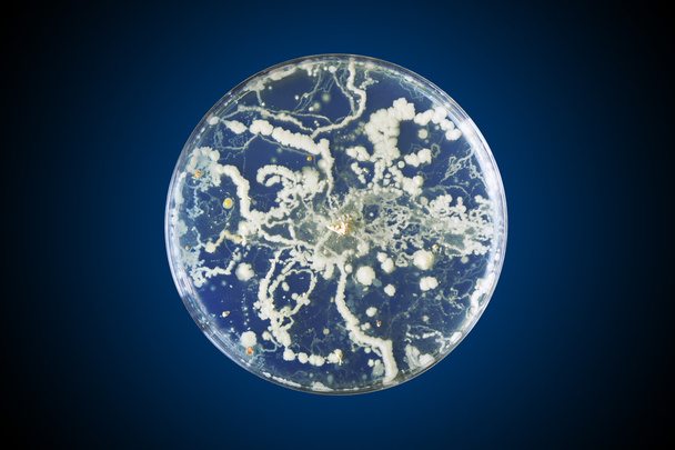 Petrimaljassa kasvavat bakteerit - Valokuva, kuva