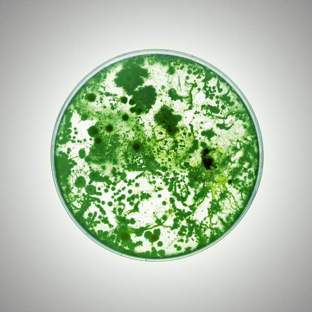 Βακτήρια που αναπτύσσονται σε τρυβλίο Petri - Φωτογραφία, εικόνα