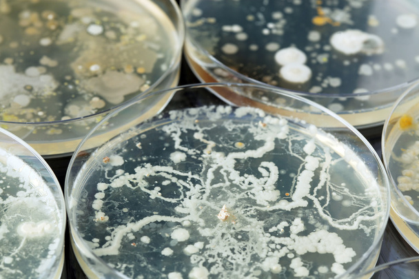 Bacterias que crecen en placas de Petri
 - Foto, Imagen