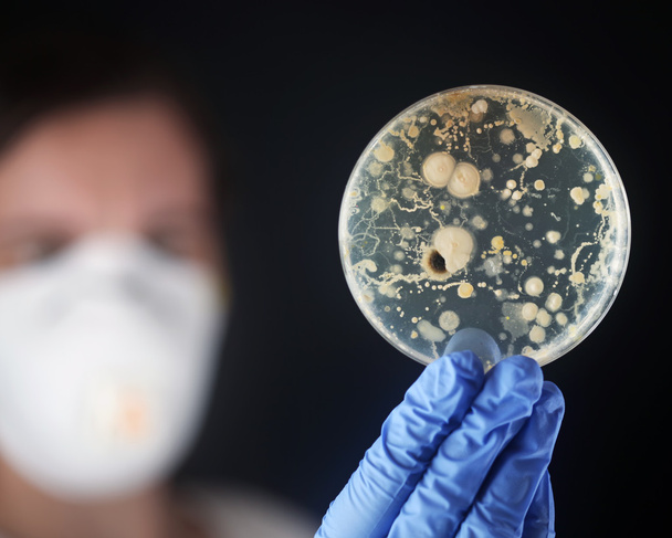 Behandeling van bacteriën in een petrischaal - Foto, afbeelding