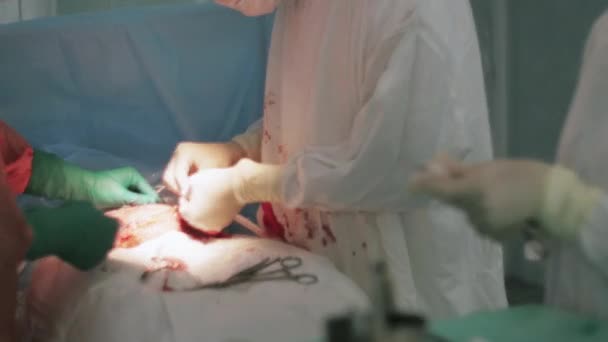 Surgeons sew up stomach of woman by needle and thread. Cesarean section. Nurse - Кадри, відео