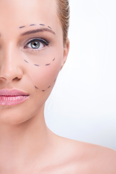 Marking for cosmetic plastic surgery - Photo, Image