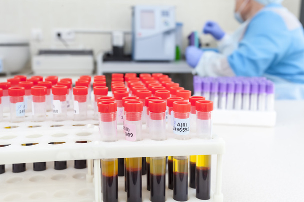 tubes avec un test sanguin dans un laboratoire médical
 - Photo, image