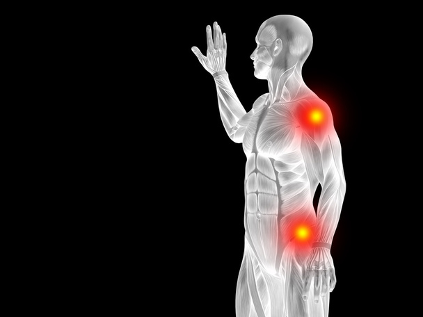  insan anatomisi, eklem veya eklem ağrısı - Fotoğraf, Görsel
