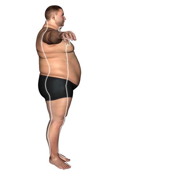 Толстый лишний вес против здорового человека
  - Фото, изображение