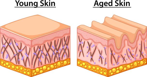 Schema che mostra la pelle giovane e invecchiata
 - Vettoriali, immagini