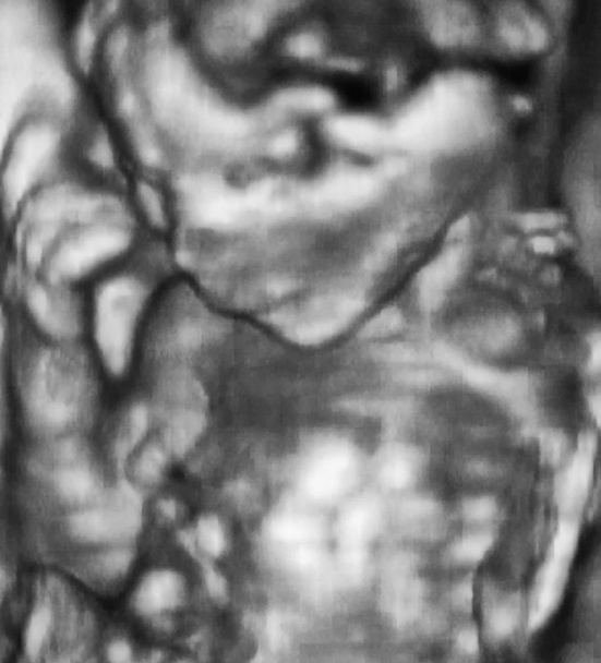 3D-s ultrahang elemzés egy 4 hónapos magzat - Fotó, kép