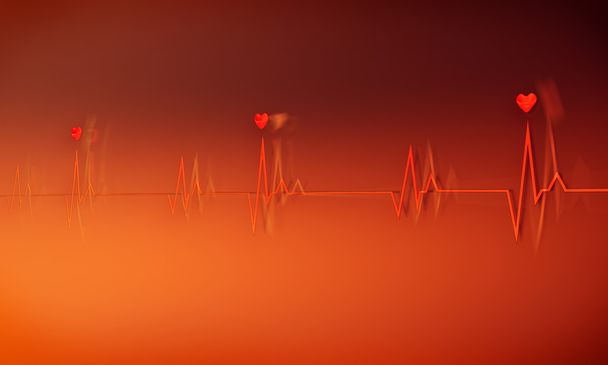 Image of a dramatic electrocardiogram in red and orange - Photo, Image