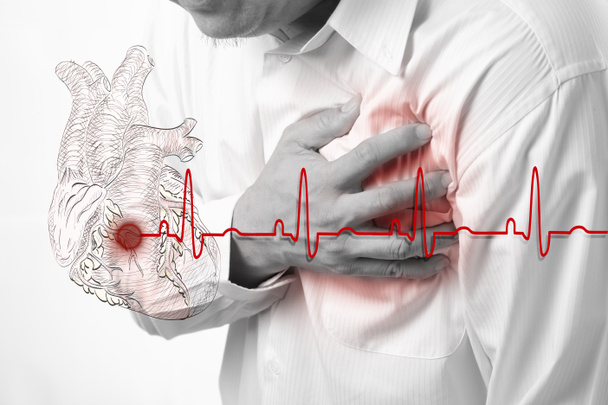 Attacco di cuore e battito cardiaco sfondo cardiogramma
 - Foto, immagini