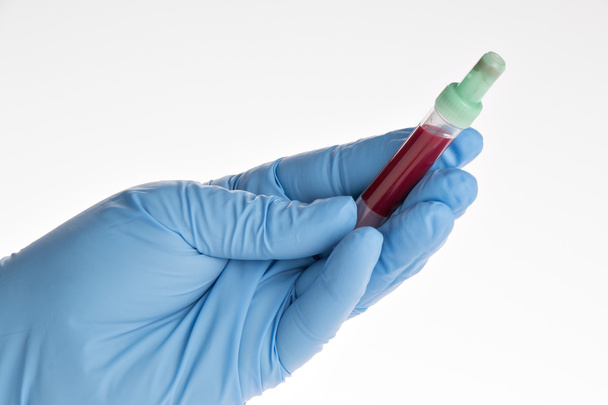 Esami del sangue, campioni di sangue su un modulo di laboratorio
 - Foto, immagini