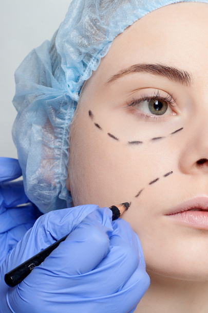 Beautiful young woman perforation lines plastic surgery operatio - Foto, Bild