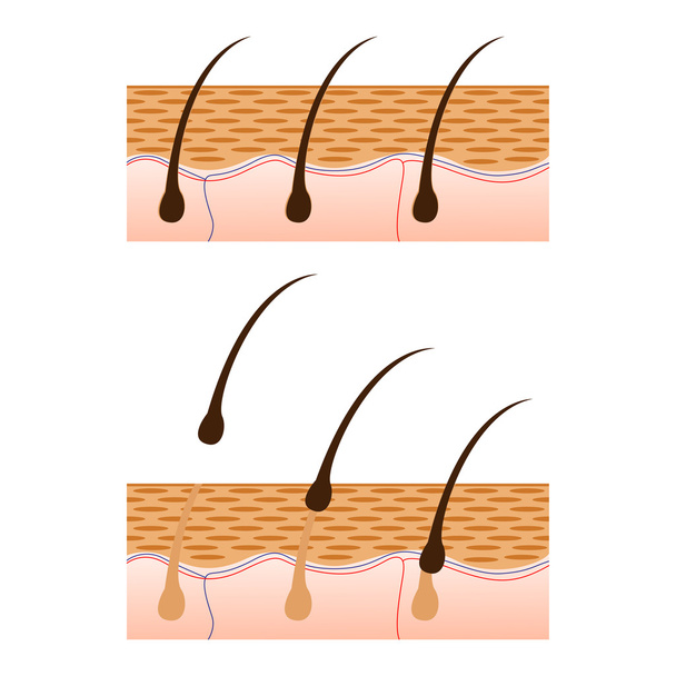 Épilation et peau avec vue de la coupe des cheveux
. - Vecteur, image