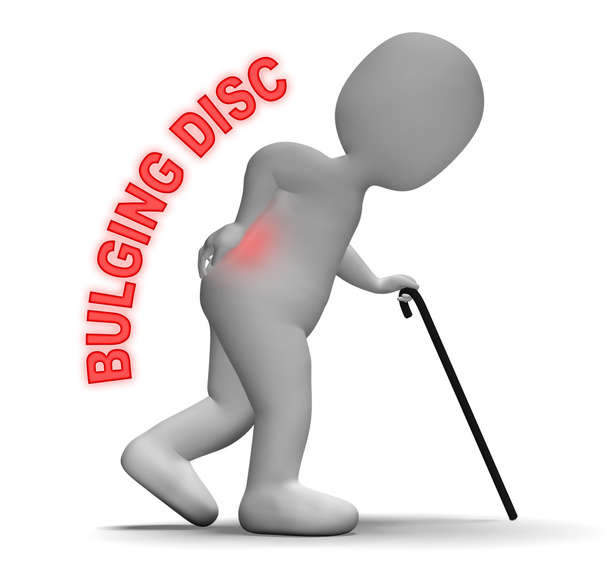 Bulging Disc montre retour Chiropracteur 3d rendu
 - Photo, image