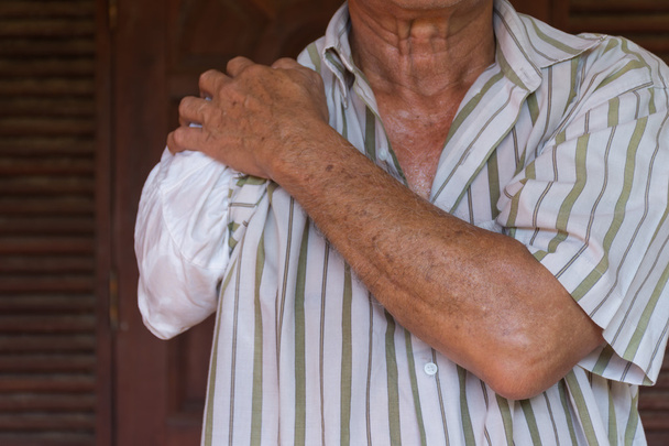 Asie homme âgé avec un bras et un bras prothétique
 - Photo, image