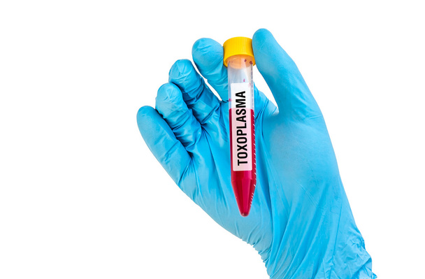 Tube à essai avec échantillon de sang pour TOXOPLASMA
 - Photo, image