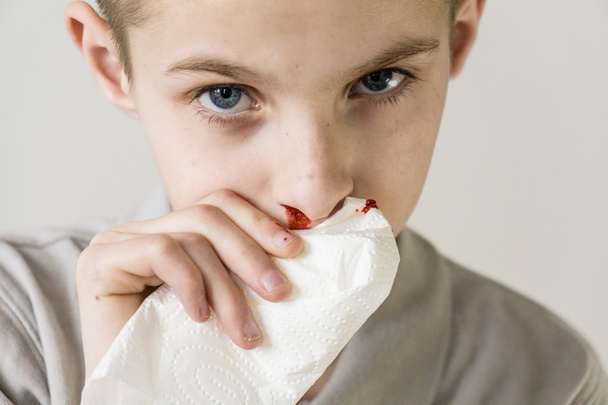 One serious boy uses tissue to stop bleeding nose - Foto, imagen