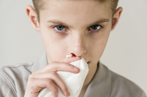 Junge im grauen Hemd hält Gewebe an blutiger Nase - Foto, Bild