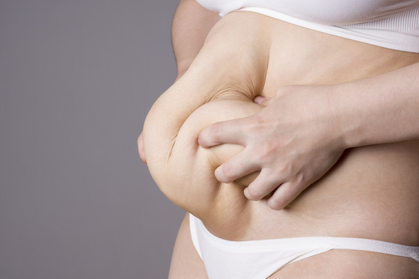 Obesity female body, fat woman belly close up - 写真・画像