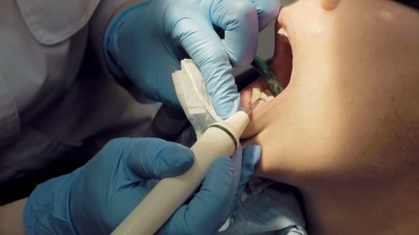 Femme plaque dentaire à ultrasons odontolith enlèvement
 - Séquence, vidéo