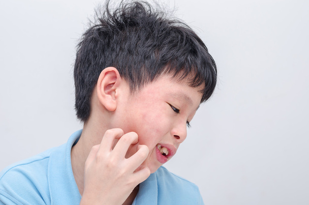 karcolás az allergia arcát fiú - Fotó, kép