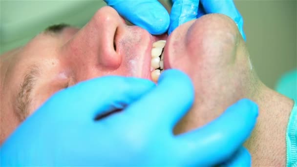 Dentist Reduce A Patient's Jaw. Close Up - Filmmaterial, Video