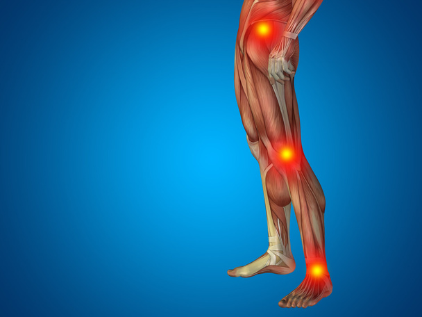  joint or articular pain, ache - Photo, Image