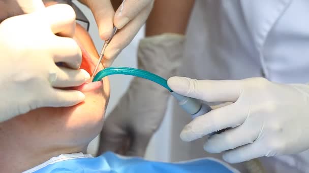 стоматолог робить процедуру пацієнту
 - Кадри, відео