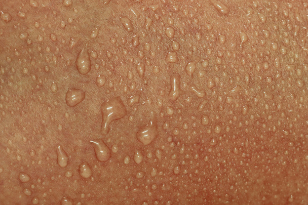 Human Skin and Sweat - Photo, Image