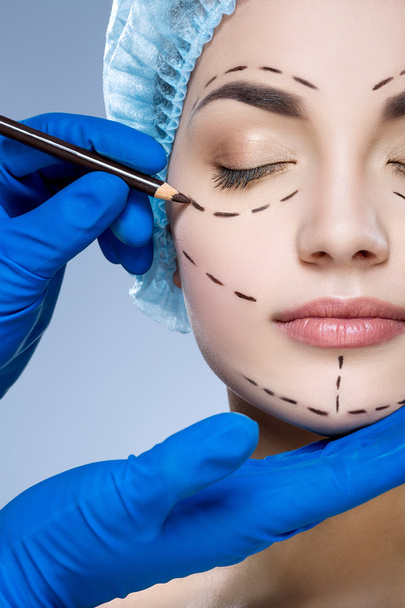 Perforation lines on patient's face - Fotó, kép