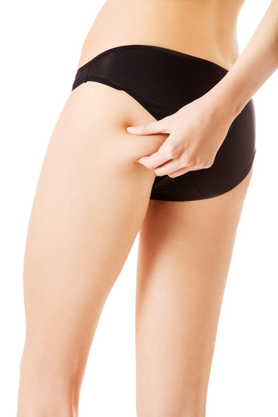 Female squeezes cellulite skin on her legs. Close-up shot on white background. - Φωτογραφία, εικόνα