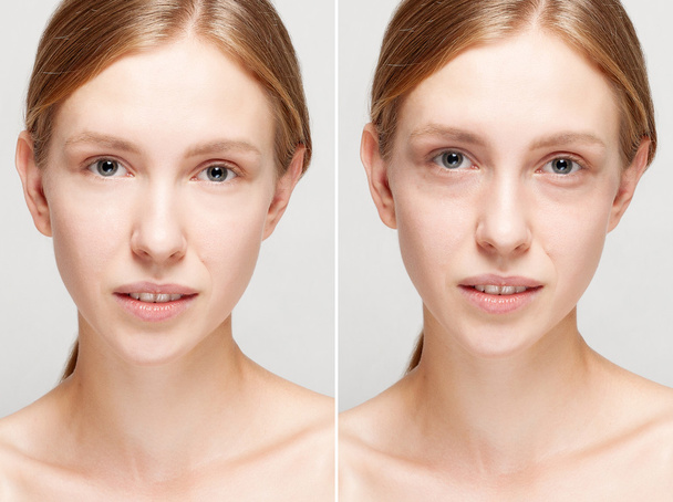Avant et après l'opération cosmétique
. - Photo, image