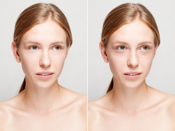Before and after cosmetic operation. - Fotografie, Obrázek