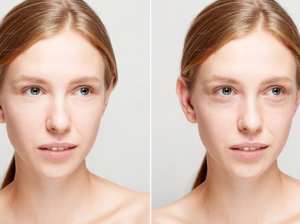 Kozmetikai művelet előtt és után. - Fotó, kép
