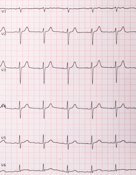 batimentos cardíacos cardiograma
  - Foto, Imagem