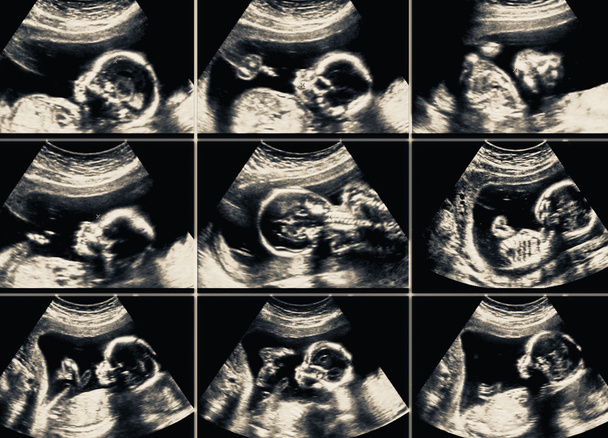 Ultrasound scans collage during pregnancy at the end of third mo - Photo, Image