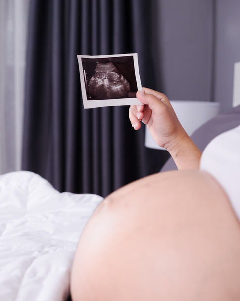 pregnant woman with ultrasound image of baby sitting on bed in b - Fotoğraf, Görsel