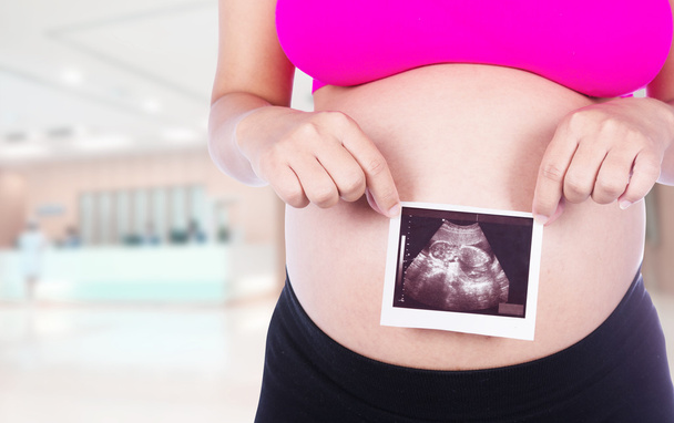 Pregnant woman hands holding ultrasound photo in hospital backgr - Foto, Imagen
