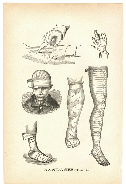 Illustrationen von bandagierten Verletzungen aus einem medizinischen Fachbuch - Foto, Bild