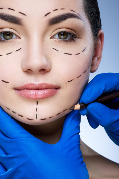 Lignes de perforation sur le visage du patient
 - Photo, image