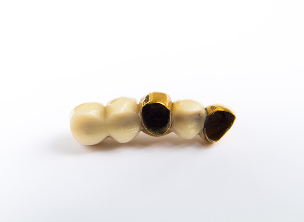 Dental ceramic and gold tooth crowns on white background. Isolated. - Photo, Image